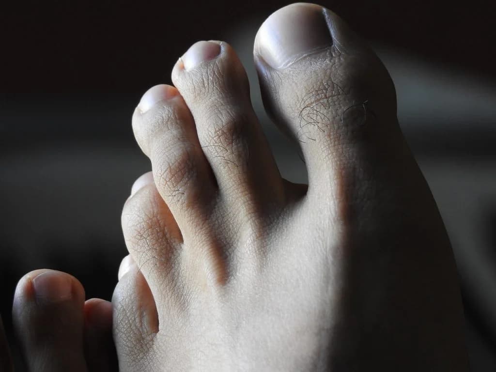 Why Do My Nails Look Funny? - Podiatry health article from FALL Clinic Perth