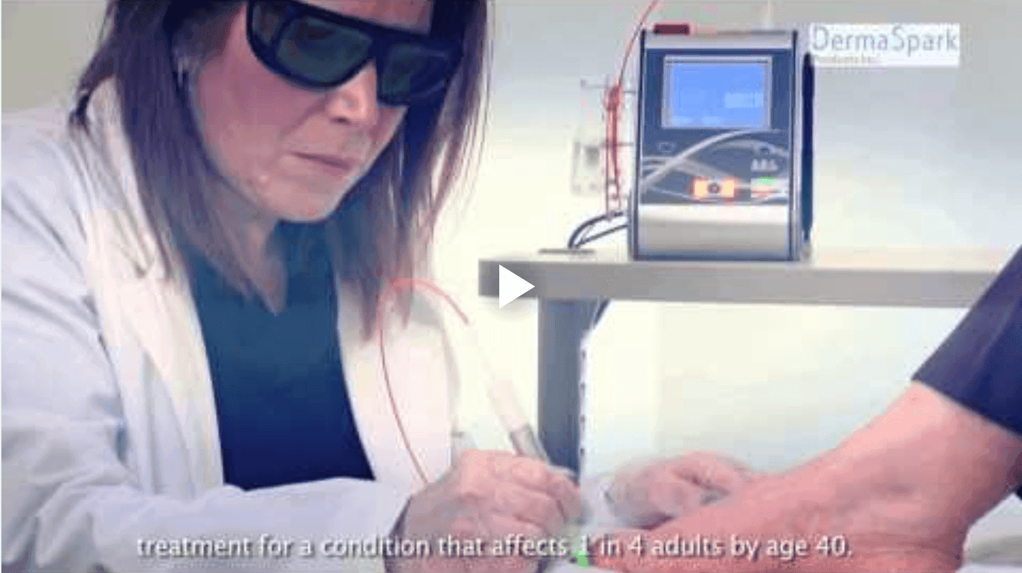 Laser Treatment for Fungal Nail Infections - Podiatry health article from FALL Clinic Perth