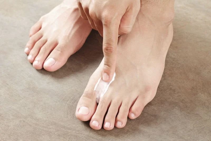 Tinea pedis/Athlete’s foot - Podiatry health article from FALL Clinic Perth