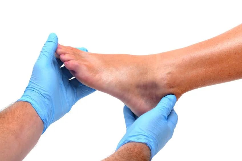 Lateral Ankle Repair - Podiatry health article from FALL Clinic Perth