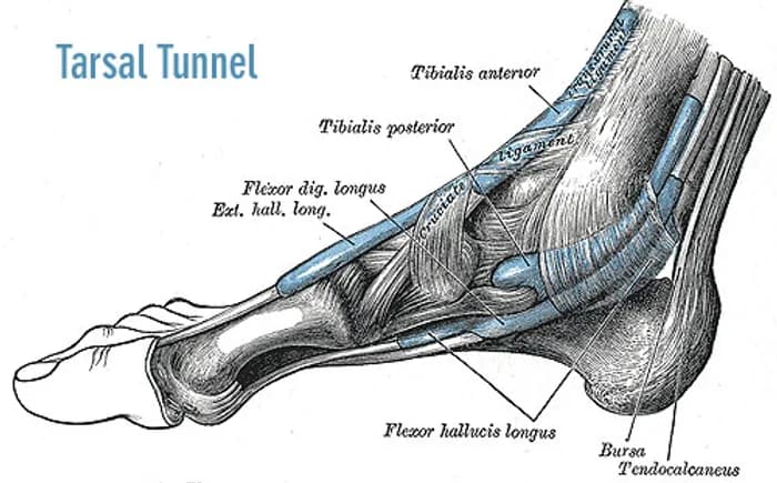 Tarsal Tunnel Syndrome - Podiatry health article from FALL Clinic Perth